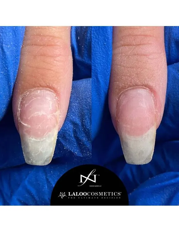 Θεραπεία νυχιών IBX Duo Pack - Image 4